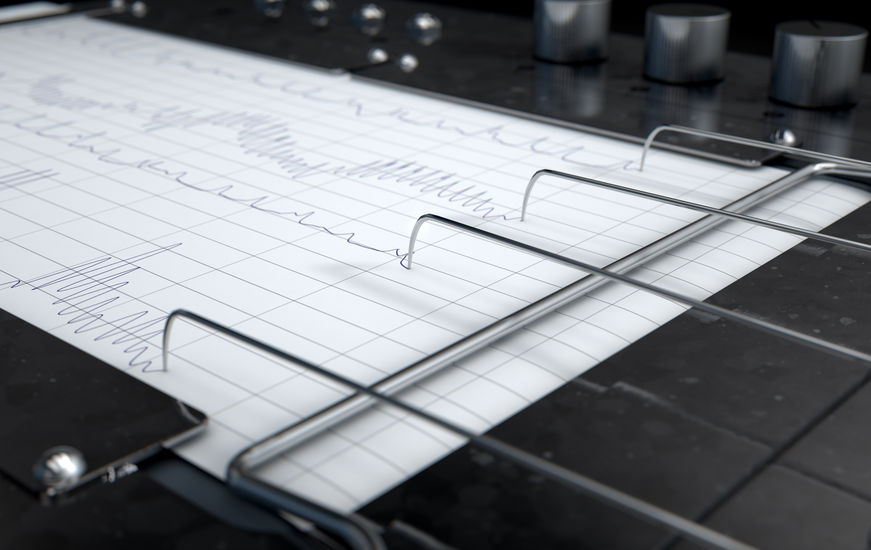 A polygraph test machine being used after a client called for private investigation services